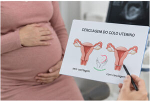 cerclagem em gestantes
